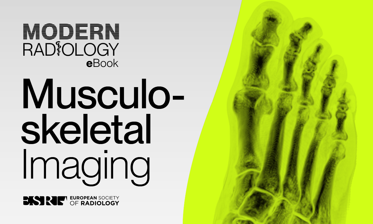 Modern Radilolgi Musculosceletal Imaging
