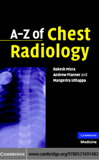 A-Z of Chest Radiology