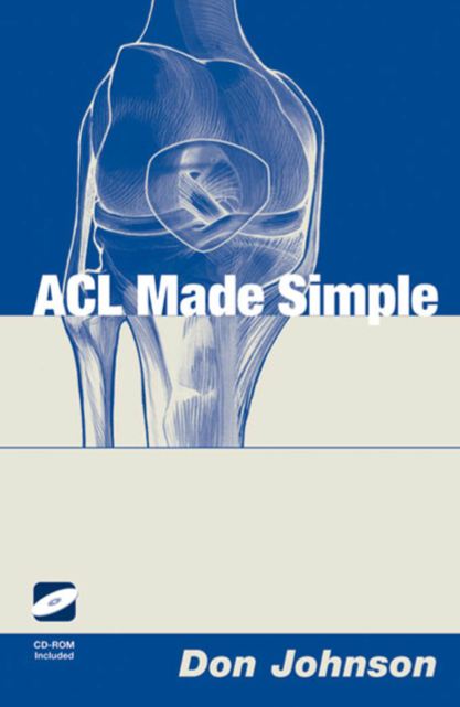 ACL Made Simple